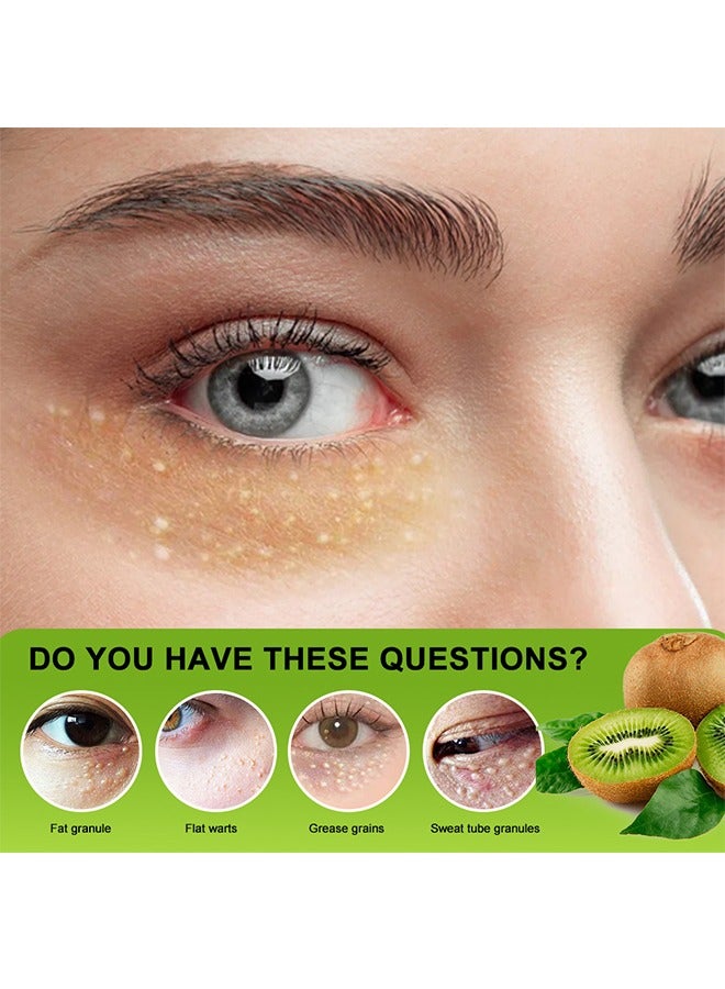 سوميفون كريم حبيبات الدهون فيتامين ه - كريم طبيعي ناعم لإزالة الدهون في العين ، كريم مرطب مضاد للتجاعيد ، رعاية صحة العين ، تخفيف جزيئات الدهون 20 جم - Image 5