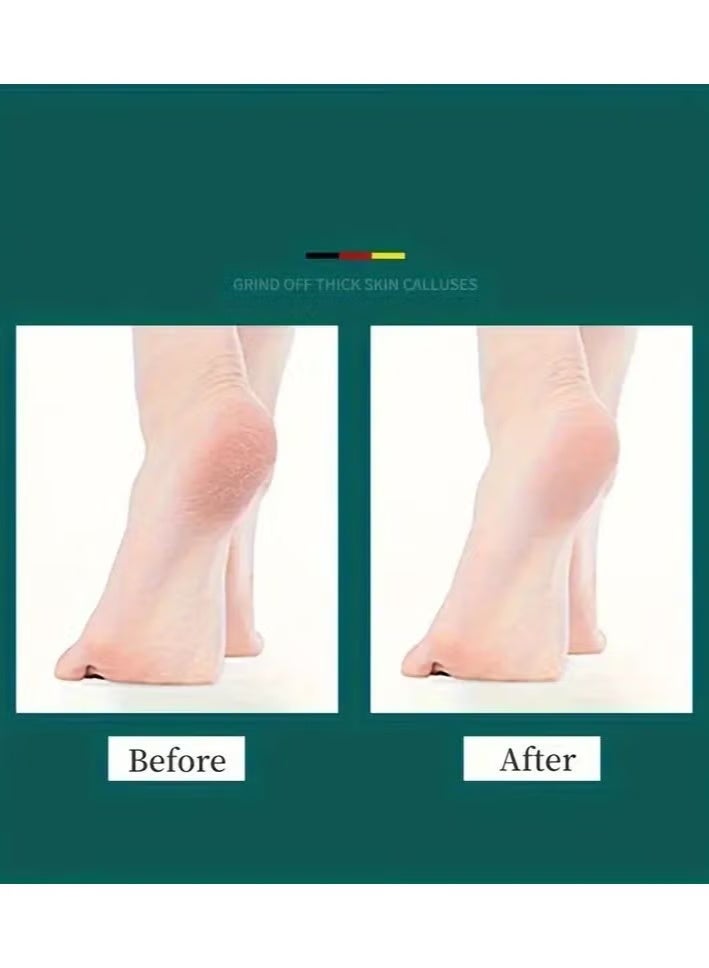 مبرد أقدام للباديكير احترافي - Image 3