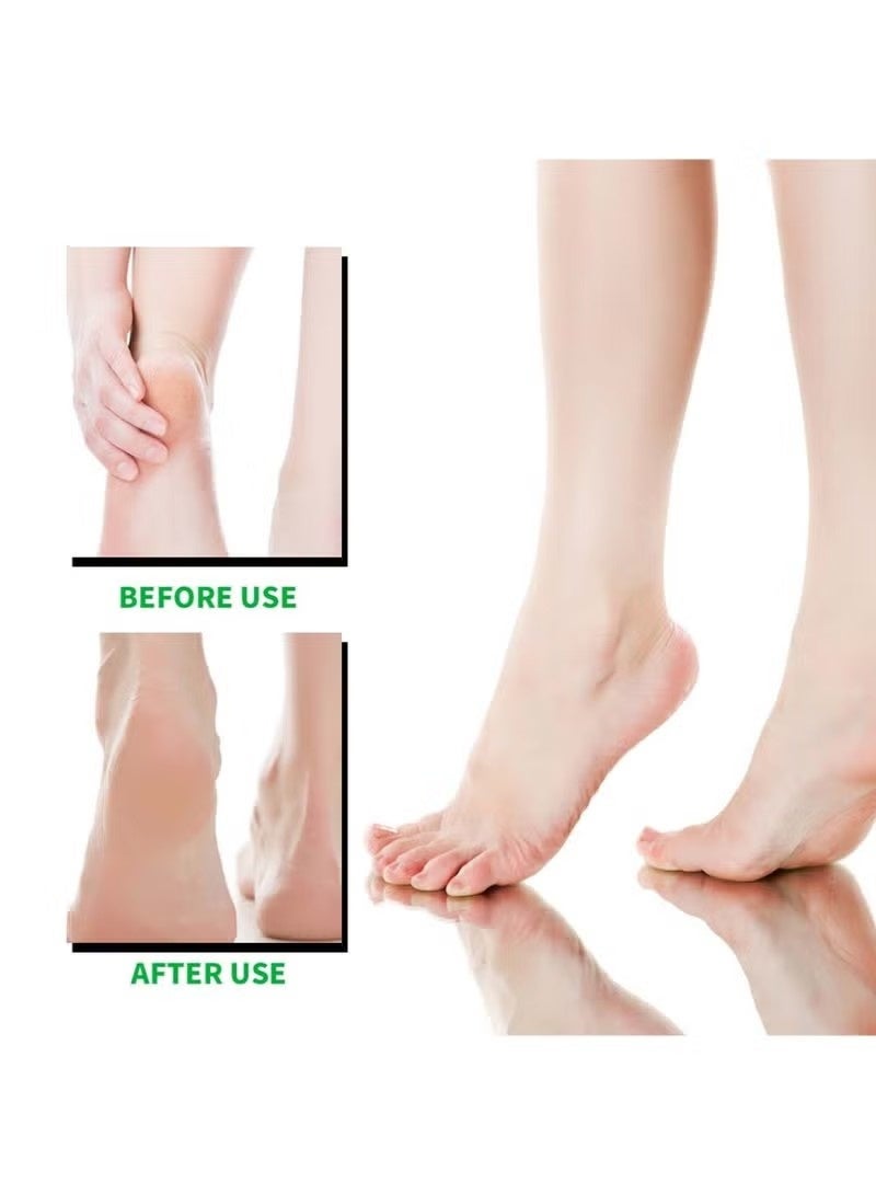 ILISYA 4 PCS Foot Mask with Shea Butter and Goat Milk, Hydrating Foot Masks for Dry Cracked Feet, Dry Skin Moisturizer for Soft and Smooth Touch Feet - Men Women - Image 3
