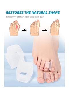 SYOSI 6 Pcs Toe Corrector Straightener for Overlapping Toes Spacers Separators Women and Men  - Image 4