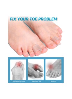 SYOSI 6 Pcs Toe Corrector Straightener for Overlapping Toes Spacers Separators Women and Men  - Image 2