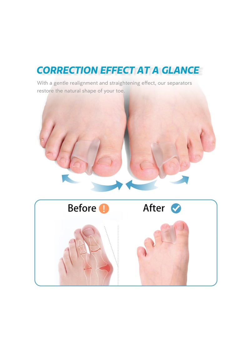 SYOSI - 6 Pcs Toe Corrector Straightener for Overlapping Toes Spacers Separators Women and Men - Image 1