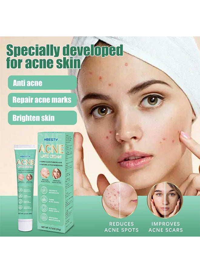HBESTY Acne Care Cream，Acne Treatment Face Cream，Oil Control Anti Acne Facial Care ，Acne Spot ，Cystic Acne，Fungal Acne ，Face Acne Spot Treatment and Acne Scar Treatment Post Acne Marks Treatment，Pimple Remover， Acne Repair 20g - Image 5