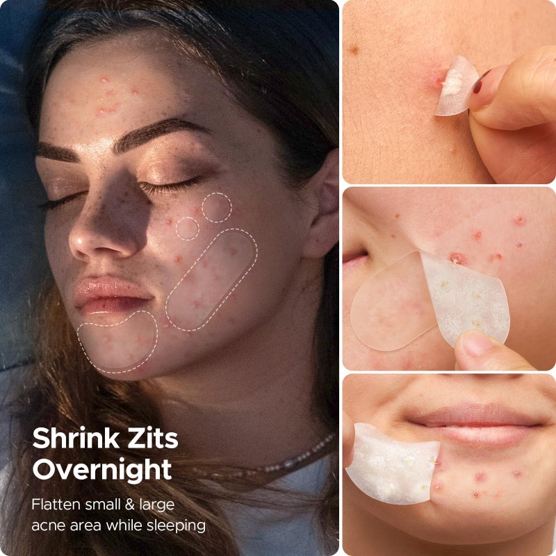 LitBear Pimple Patches for Face, 400 Counts Day and Night Acne Patches, Hydrocolloid Patches for Covering Zit and Blemishes, Large Breakouts, 5 Sizes Thin & Thick Spot Dots Stickers for Chin, Forehead - Image 4
