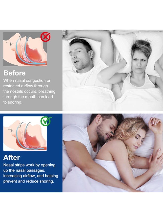شرائط أنف مغناطيسية لمكافحة الشخير، شرائط لتسهيل التنفس أثناء الرياضة والنوم، جهاز لتخفيف انسداد الأنف - Image 4