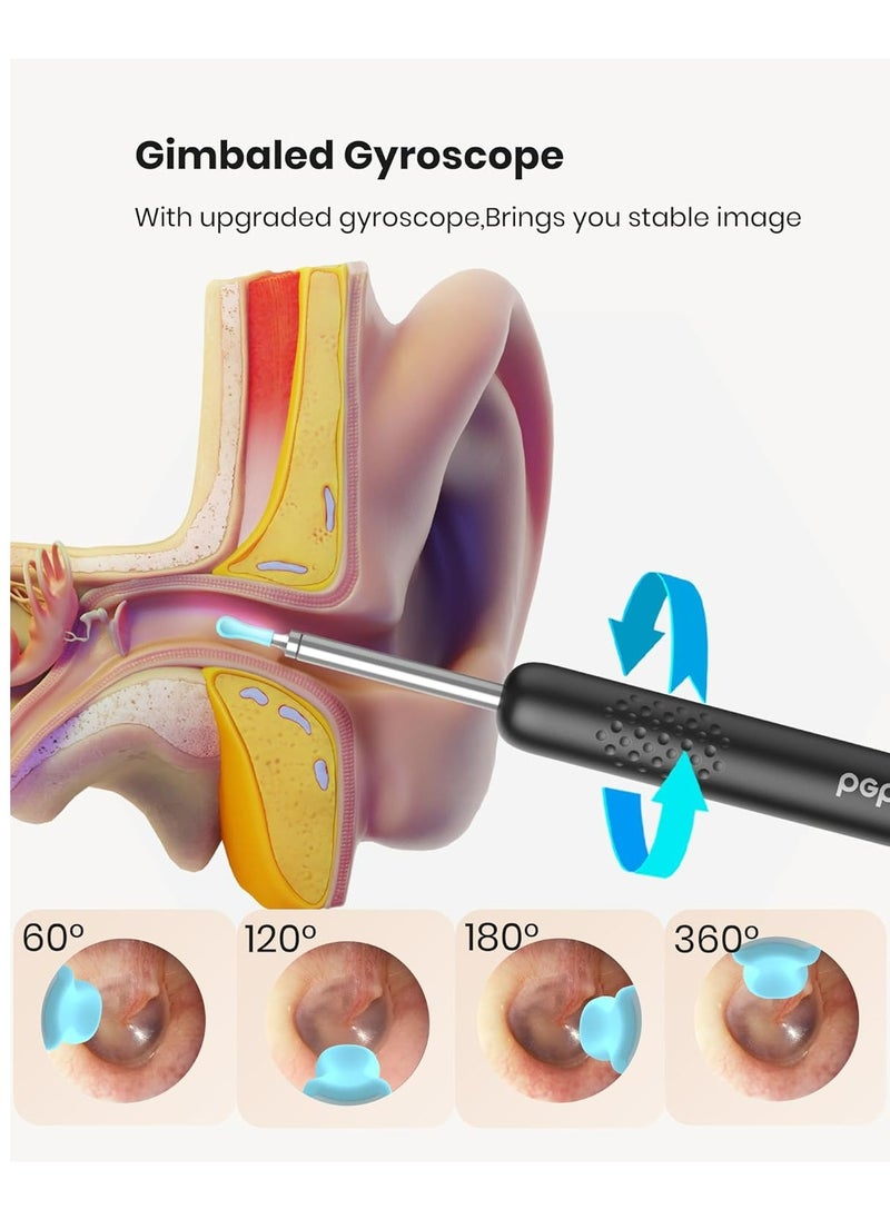 R1 Wireless Smart Visual Ear Stick With 1080P Otoscope HD Camera & 6 LED Lights For Ear Cleaning 2 Silicone Ear Scoops Ear Cleaner 300W - Black