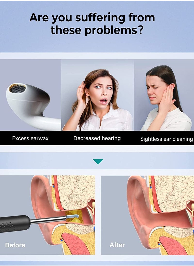 R1 Wireless Smart Visual Ear Stick With 1080P Otoscope HD Camera & 6 LED Lights For Ear Cleaning 2 Silicone Ear Scoops Ear Cleaner 300W - Black