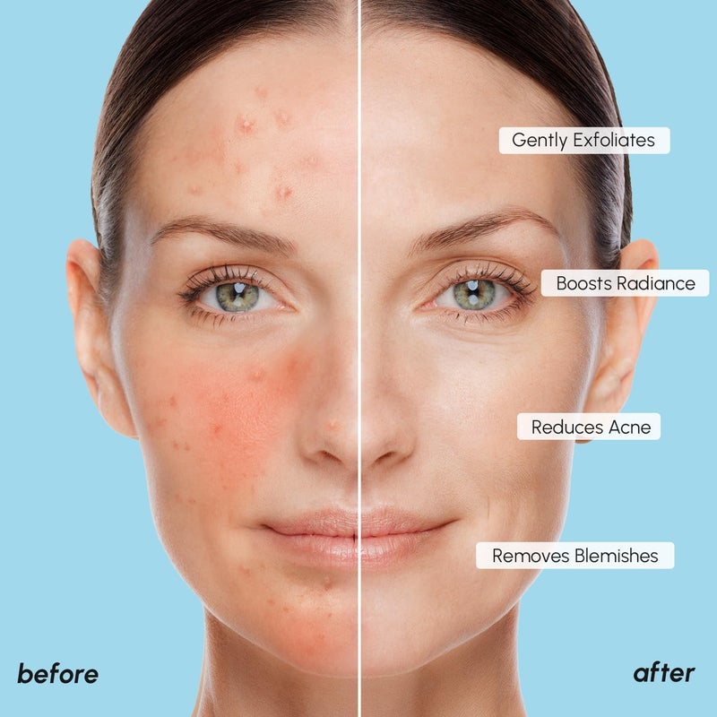 MAREE Glycolic Acid Polishes 2 PACK - Toner Polishes for Face Cleansing - Tea Tree Oil, Salicylic Acid & Vitamins E, B3, B5 - Facial Peel & Radiance Deep Cleaning Effect - Image 5