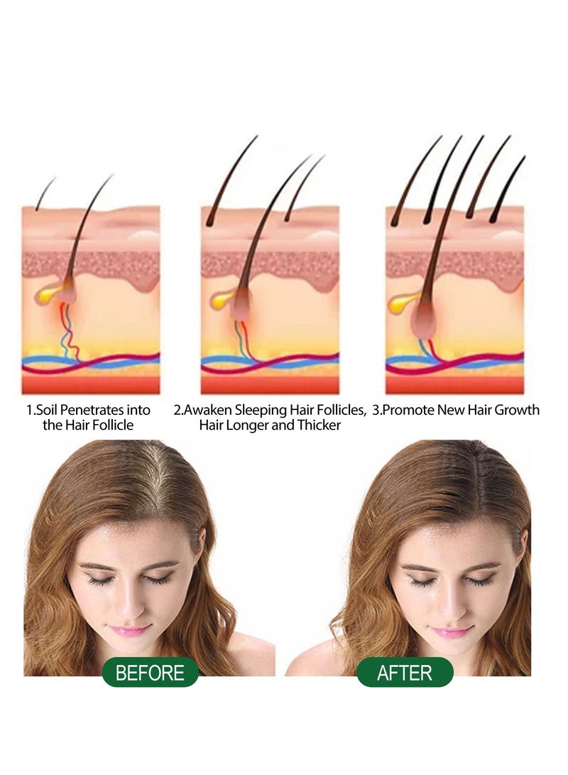 إيلهو روزماري شامبو صابون كثيف ينظف فروة الرأس ، ويحسن من جفاف ، تجعيد الشعر ، وإزالة القشرة ، وتقوية الشعر ، ويمنع تساقط الشعر - Image 5
