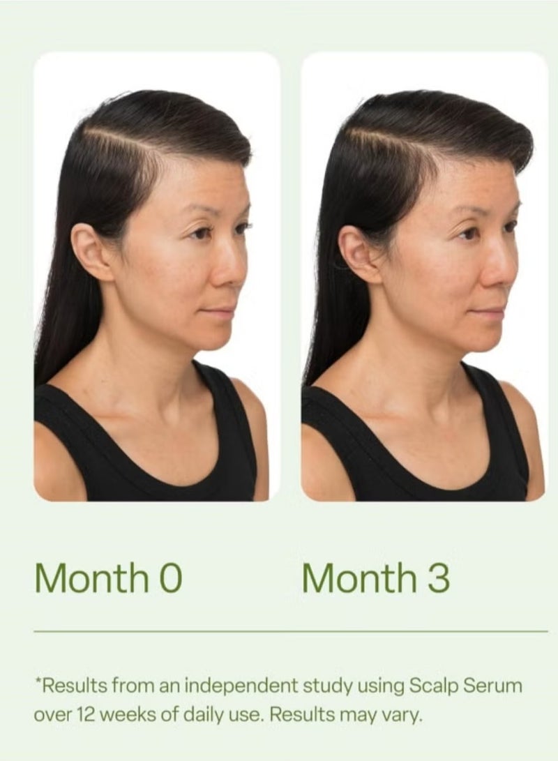 Divi Scalp Serum for Thinning Hair, 30ml – Clinically Tested, Nourishing Formula with Amino Acids, Caffeine & Rosemary Oil – Promotes Healthy Scalp & Fuller-Looking Hair, Reduces Oil & Product Buildup - Image 4