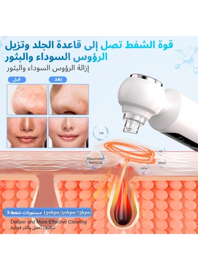Portable Skin Rejuvenation Device, Home Spa Essential, Facial Cleansing Device, Facial Vacuum Cleaner, Blackhead And Whitehead Remover, Blackhead Extraction Tool, 4 Modes, 6 Suction Heads, Visible Water Tank, With Hot Water Function - Image 3