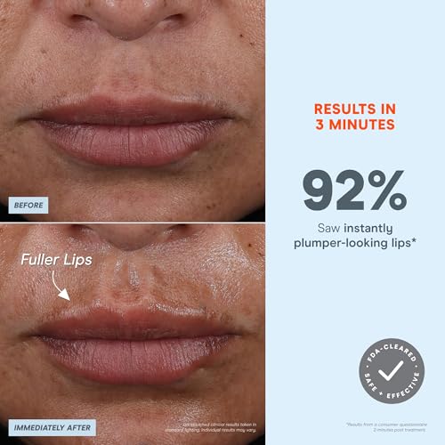 NuFACE FIX MicroWand Microcurrent Facial Device, FDA Cleared - Eyes, Lips & Lines Treatment with Serum Activator - Lip Plumper, Eye Depuffing Wand, Wrinkle & Smile Line Reducer, 3 On-The-Go Modes - Image 5