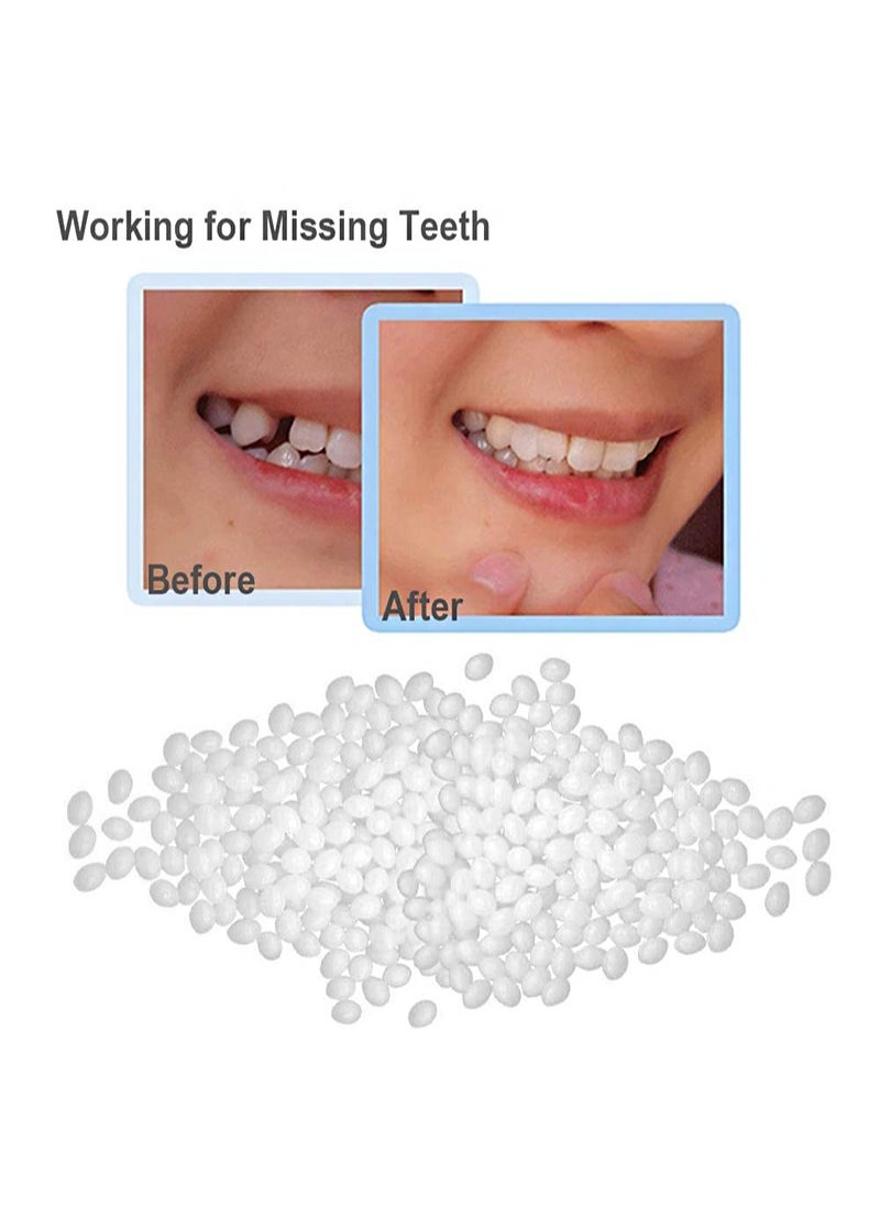 Instant Smile 3 Pack Included Thermal Forming Impression Beads，Fitting Beads，Can Be Used for Any Billy Bob Teeth OR Instant Smile Teeth  - Image 5