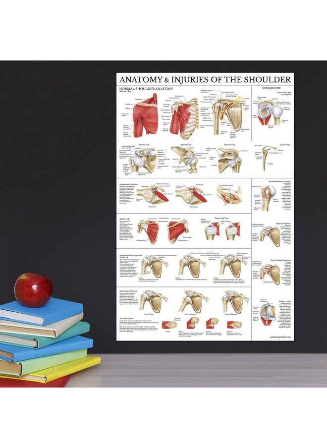 Palace Learning Palace Learning 2 Pack - Anatomy and Injuries of The Knee & Shoulder Poster Set - Anatomical Chart Set - Laminated 18" x 24"  - Image 5