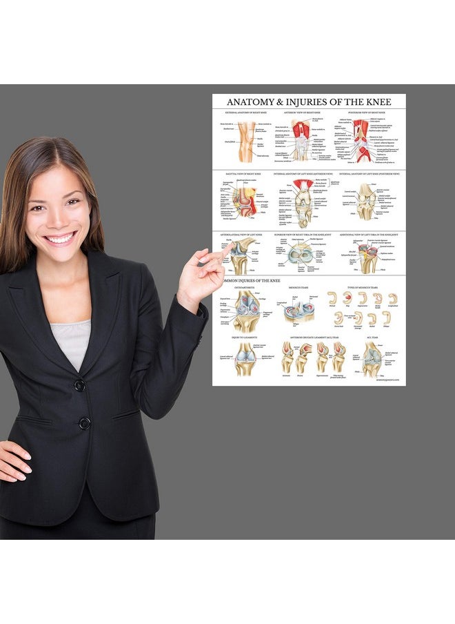 Palace Learning Palace Learning 2 Pack - Anatomy and Injuries of The Knee & Shoulder Poster Set - Anatomical Chart Set - Laminated 18" x 24"  - Image 4