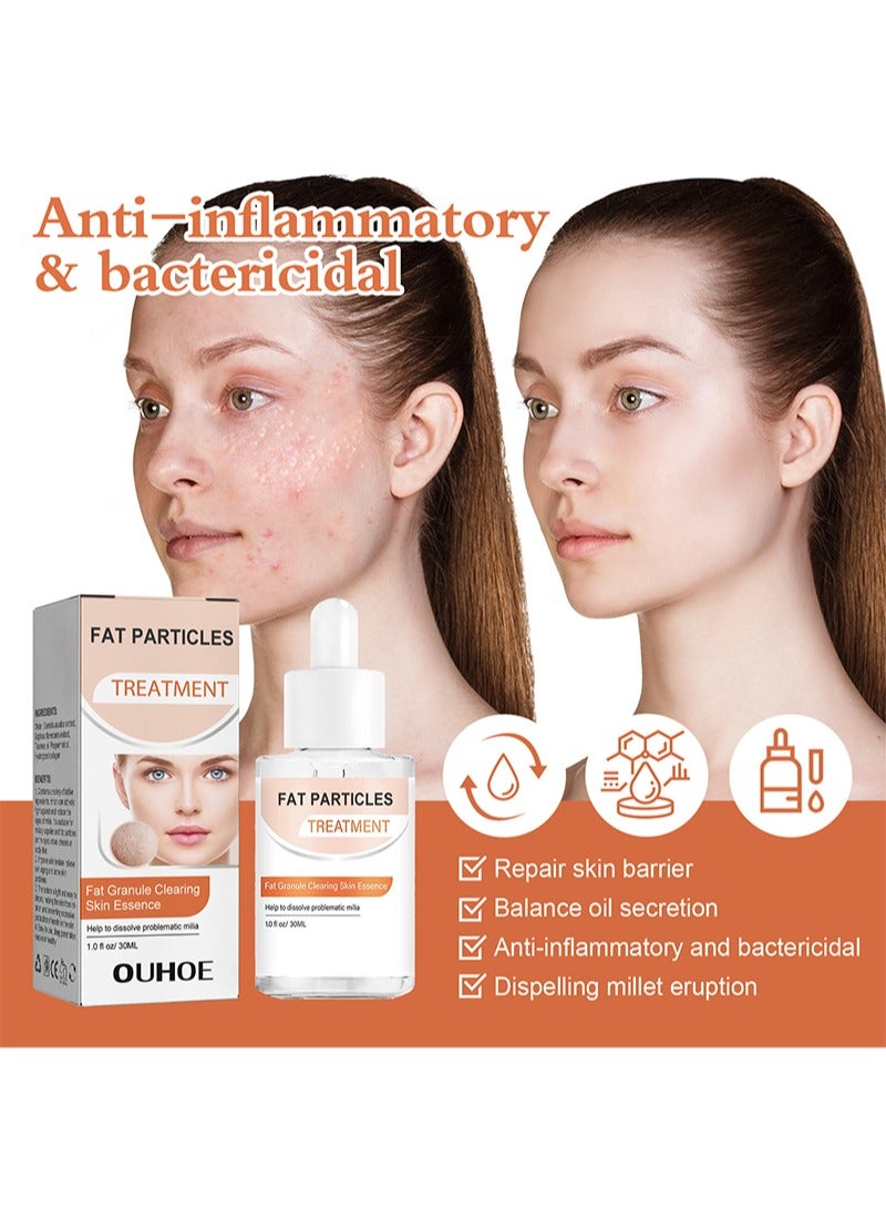 OUHOE Fat Particles Treatment,Milia Removal Treatment,Milia Blemish Treatment Helps Dissolve and Reduce Milanese, Whiteheads and Sebaceous Hyperplasia  - Image 5
