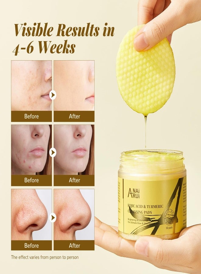 ANAI RUI Turmeric Kojic Acid Exfoliating Cleansing Pads, Deep Cleansing Brightening Pads, Exfoliating Scrub Pad for Face and Body, Acne Treatment, Skin Tone Evening,50 PCS - Image 4