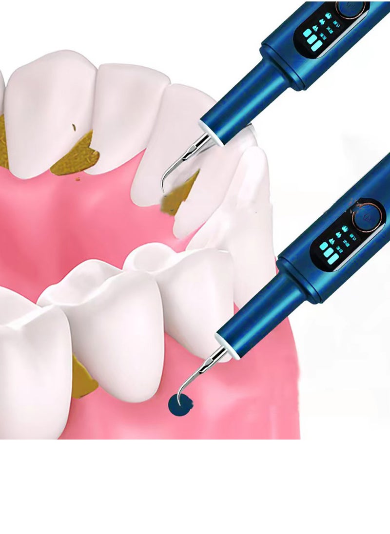 SCIENISH - SCIENISH Portable Water Dental Flosser For Teeth Cleaning Dental Oral Irrigator - Image 1