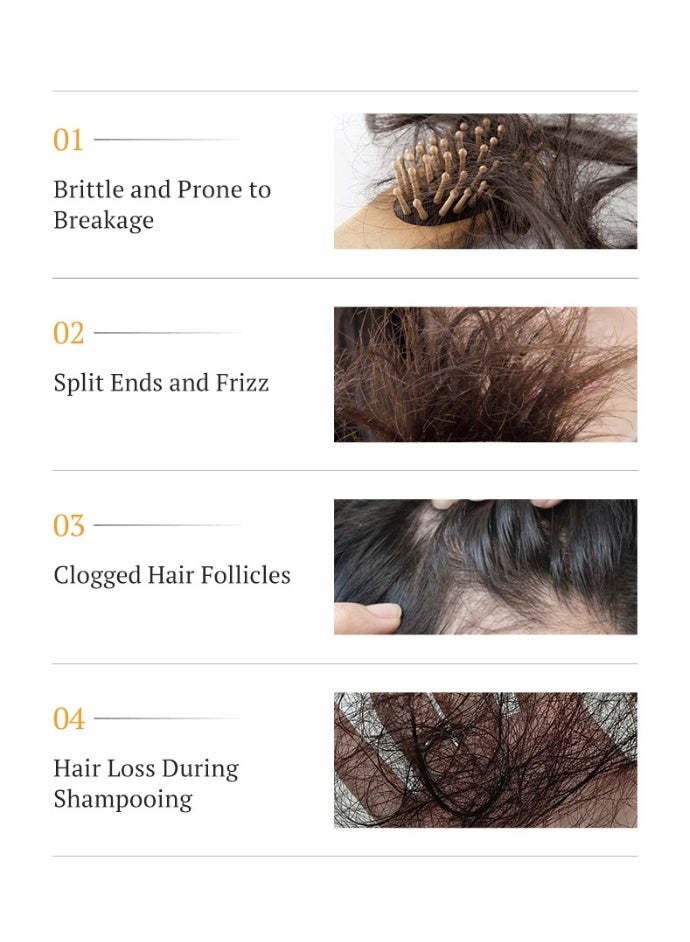 كيرميسيك شامبو مينوكسيديل بيوتين ٢٦٠ مل + بلسم ٢٦٠ مل، مجموعة مضادة لتساقط الشعر، نموه، تقوية وإصلاحه - Image 4