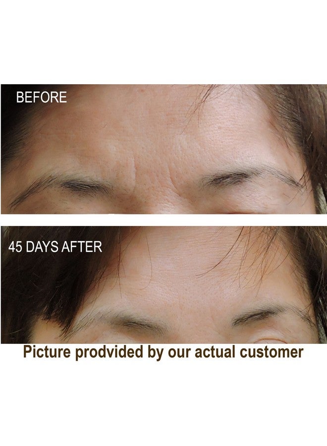 DNA CODE Skin Care Dna Code®No Needle Alternativeargireline Copper Peptide Wrinkle Reduce Serum Booster W/Snap8 Matrixyl 3000 - Image 3