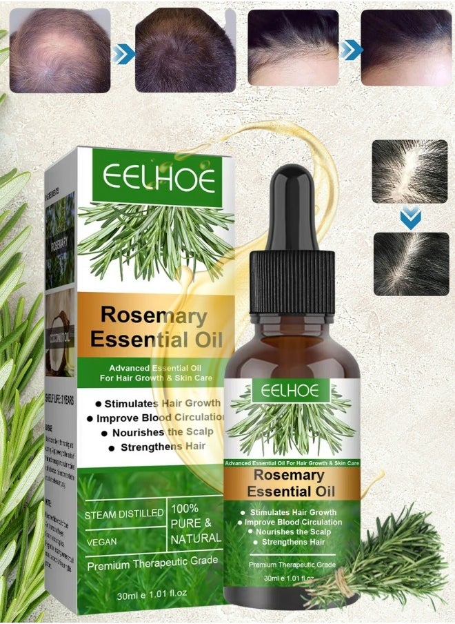 EELHOE Rosemary Essential Oil 30ml Pure Rosemary Oil for Hair Growth & Skin Care Nourishment Scalp Stimulates Hair Growth Rid of Itchy and Dry Scalp Refreshing Aromatherapy Oil for Men Women  - Image 1