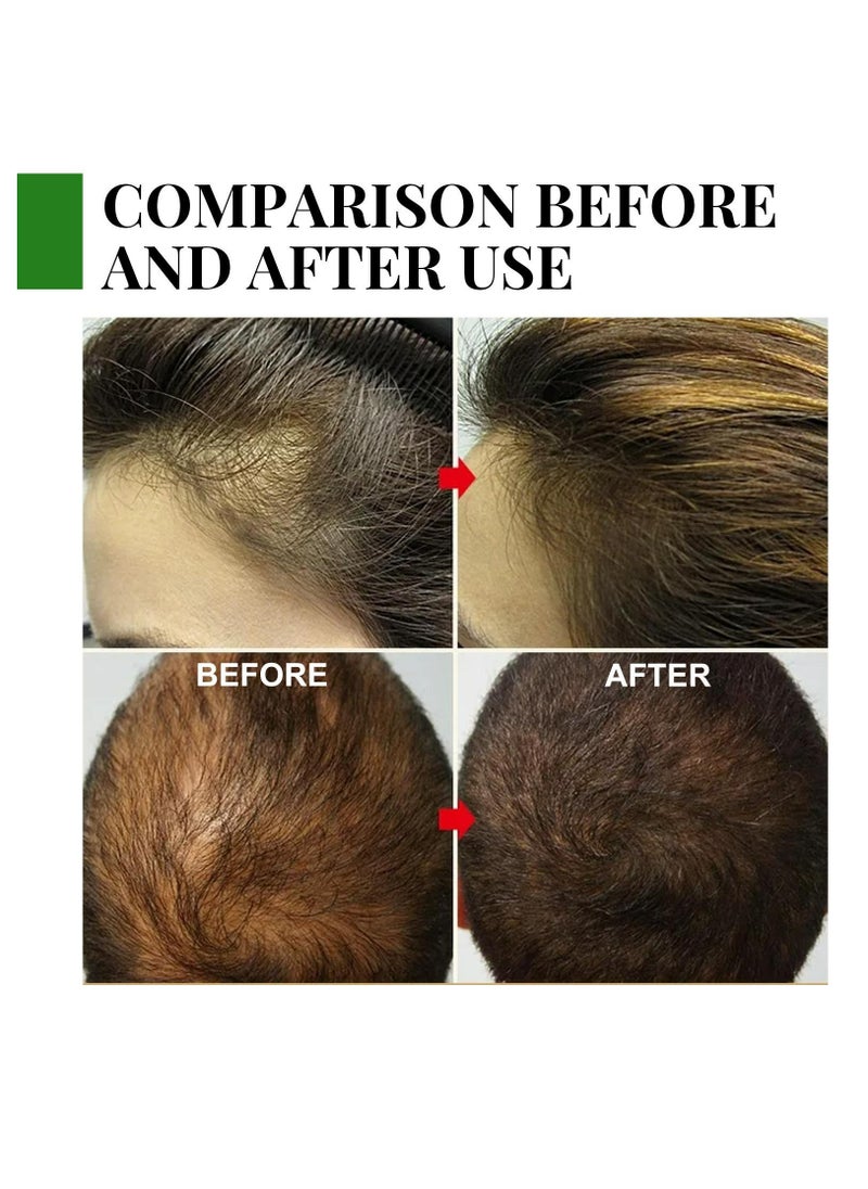 EELHOE Rosemary Essential Oil 30ml Pure Rosemary Oil for Hair Growth & Skin Care Nourishment Scalp Stimulates Hair Growth Rid of Itchy and Dry Scalp Refreshing Aromatherapy Oil for Men Women  - Image 3