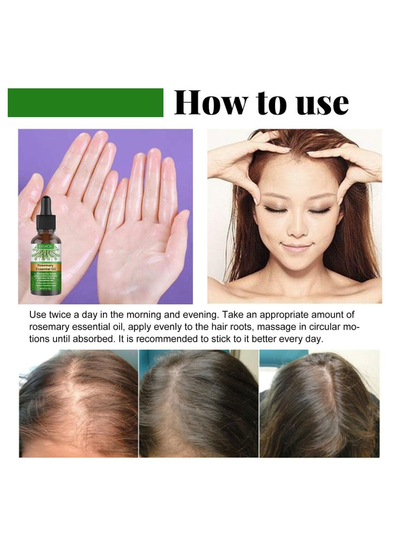 EELHOE Rosemary Essential Oil 30ml Pure Rosemary Oil for Hair Growth & Skin Care Nourishment Scalp Stimulates Hair Growth Rid of Itchy and Dry Scalp Refreshing Aromatherapy Oil for Men Women  - Image 4