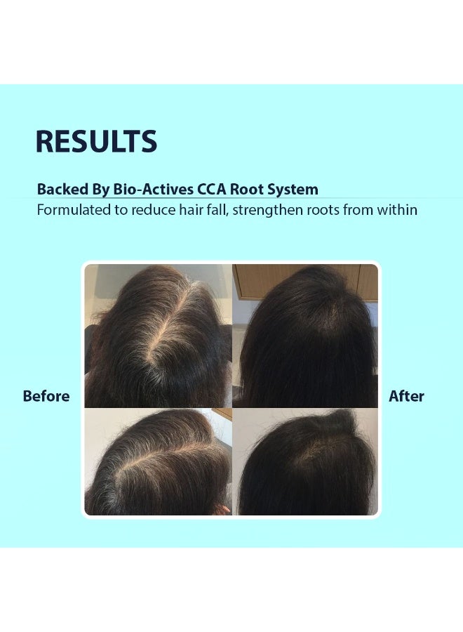 DERMISTRY Hair Fall Control Shampoo for All Hair Types - Image 4