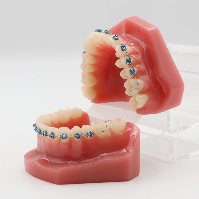 braxan 1 Pair of Temporary Tooth Decoration, Teeth Retainer Practical Brackets para Dientes Sturdy Retenedores de Dientes Ortodoncia Props for Dental Students to Practice (Blue) - Image 2