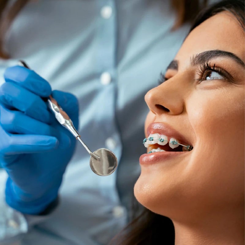 braxan 1 Pair of Temporary Tooth Decoration, Teeth Retainer Practical Brackets para Dientes Sturdy Retenedores de Dientes Ortodoncia Props for Dental Students to Practice (Blue) - Image 3