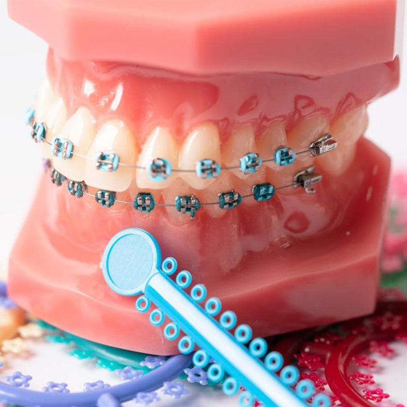 braxan 1 Pair of Temporary Tooth Decoration, Teeth Retainer Practical Brackets para Dientes Sturdy Retenedores de Dientes Ortodoncia Props for Dental Students to Practice (Blue) - Image 4