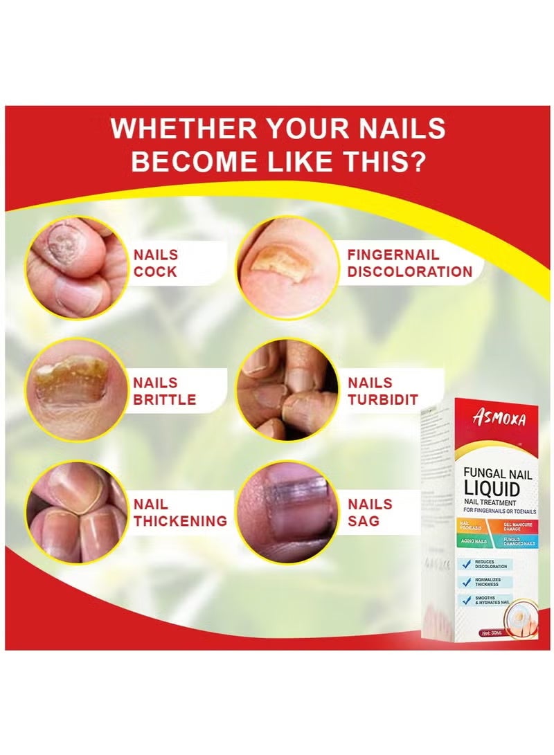 ASMOXA Fungal Nail Treatment Liquid 30ml Nail Fungus Treatment for Toenails & Fingernails Fungal Nail Renewal Anti Fungus Nail Repair Smooth & Hydrates Nail Reduce Discoloration - Image 4