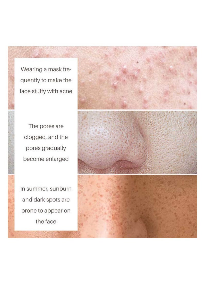 Lanthome - Tretinoin Natural Firming Cream Wrinkle Remover and Clogged Pores (30g) - Image 1