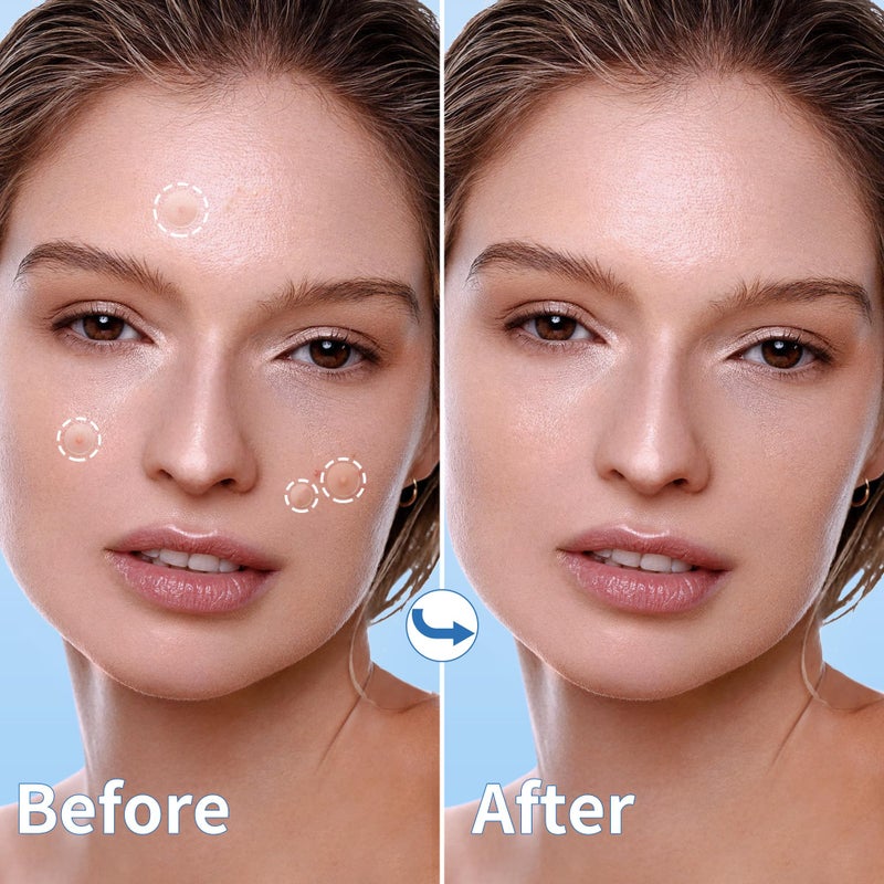 Daolyo Pimple Patches for Face - 3 Size 510 Counts Hydrocolloid Acne Patches for Covering Zits and Blemishes, Spot Stickers with Salicylic Acid, Tea Tree Oil & Calendula Oil(8mm,10mm,12mm) - Image 5