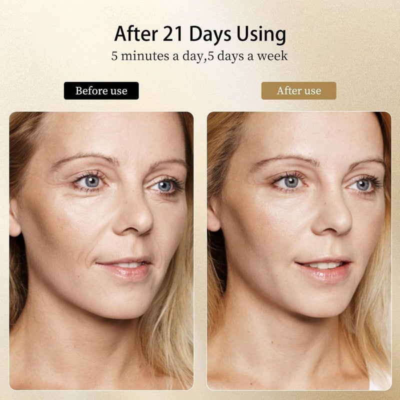 SOLARAE Facial Massager Facial Machine Skin Care for Face Neck, Face Lifting Machine, Face Tightening Machine, for Skin High Frequency Facial Machine - Image 4