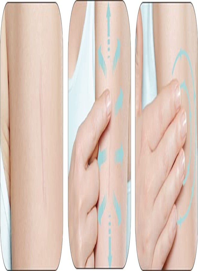 Mederma Skin Care (Helps Scars -Surgery, Injury, Burns, Acne,Stretch marks) - Image 3