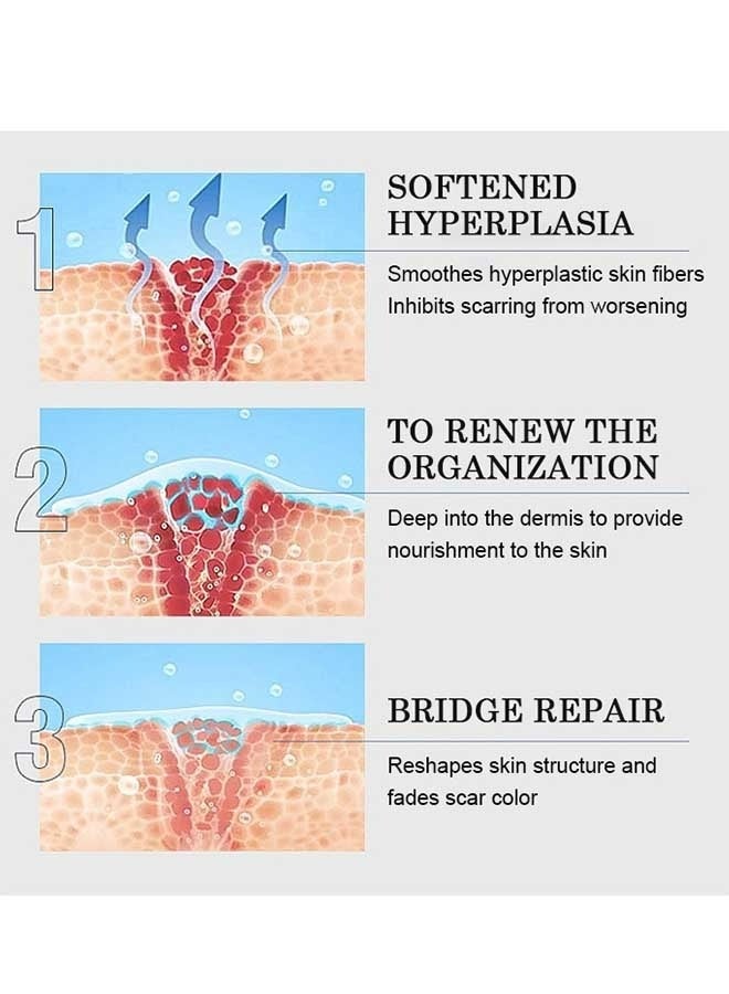 MOOYAM Scar Removal Cream, Skin Repairing Cream Fade Scars/Stretch Marks/Acne Treatment, Improve Scar Skin, Deeply Moisturizes Skin  - Image 5