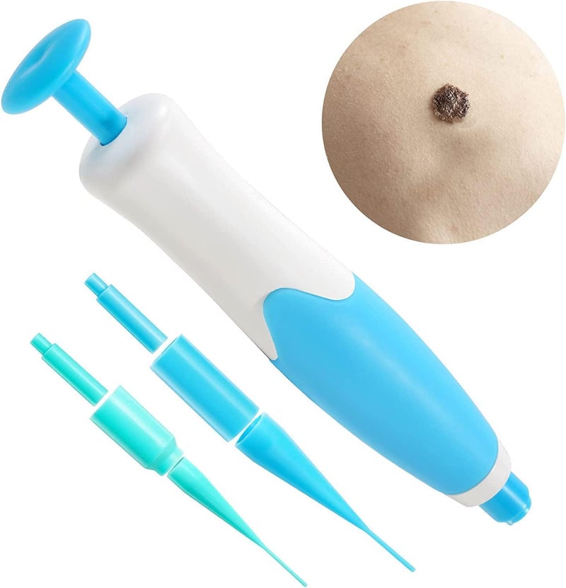 KLIVE Painless Skin Tag Remover Tool Kit with 40 Skin Tag Bands, Wart Removal Kit for Face Neck Fingers Legs, Skin Tag Removal Device for Home Use, Skin Care Tool for Mole Wart and Tag Removal - Image 2