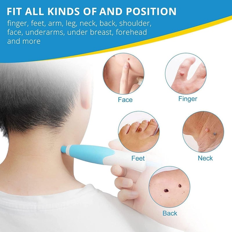 KLIVE Painless Skin Tag Remover Tool Kit with 40 Skin Tag Bands, Wart Removal Kit for Face Neck Fingers Legs, Skin Tag Removal Device for Home Use, Skin Care Tool for Mole Wart and Tag Removal - Image 4