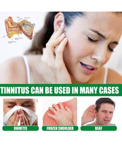 SOUTH MOON Ear Drop for Tinnitus,for Hearing Loss and Reduces Itching,Tinnitus Relief,Ear Ringing Relieving Oil,Tinnitus Ear Drop,Ear Drops Treatment  - Image 2
