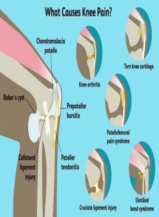 Functional Knee Support Open Patella Hinge Knee Brace Support Knee Support (Blue) (LARGE) - Image 4