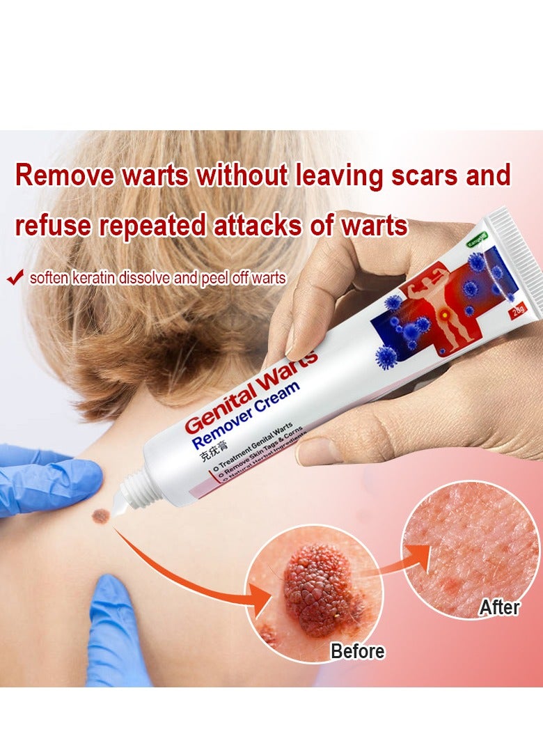 KanyeHB Wart Remover, Wart Removal Ointment, Wart Remover Freezer, Fast Acting Wart Gel Maximum Strength, Wart Freezer, Genital Wart Remover, Wart Cleansing Cream, Wart Cream (20g) - Image 2