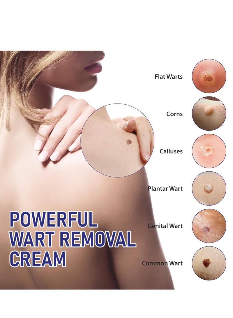 KanyeHB Wart Remover, Wart Removal Ointment, Wart Remover Freezer, Fast Acting Wart Gel Maximum Strength, Wart Freezer, Genital Wart Remover, Wart Cleansing Cream, Wart Cream (20g) - Image 5