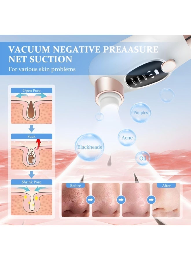 Blackhead Remover Vacuum, Electric Pore Cleaner with 3 Adjustable Suction Levels, 6 Replaceable Suction Heads, USB-C Rechargeable Facial Pore Vacuum for Blackhead &Oil Removal - Image 2
