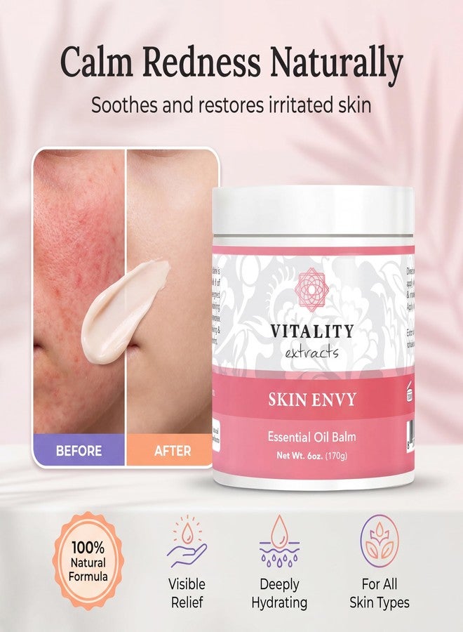 Vitality Extracts Skin Envy Essential Oil Balm - 6oz, Moisturizer, Beeswax, Vitamin A, Skin Care, All Natural, Coconut Oil - Image 5