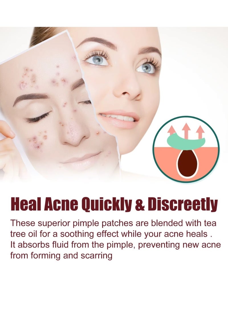 Jaysuing 200 قطعة لاصقات حب الشباب هيدروكولود غير جافة لوجه ملصقات حب الشباب على شكل قلب ملونة مع حمض الهيالورونيك وزيت شجرة الشاي وزيت السنتيلا لاصقات حب الشباب لتغطية العيوب والبثور - Image 3