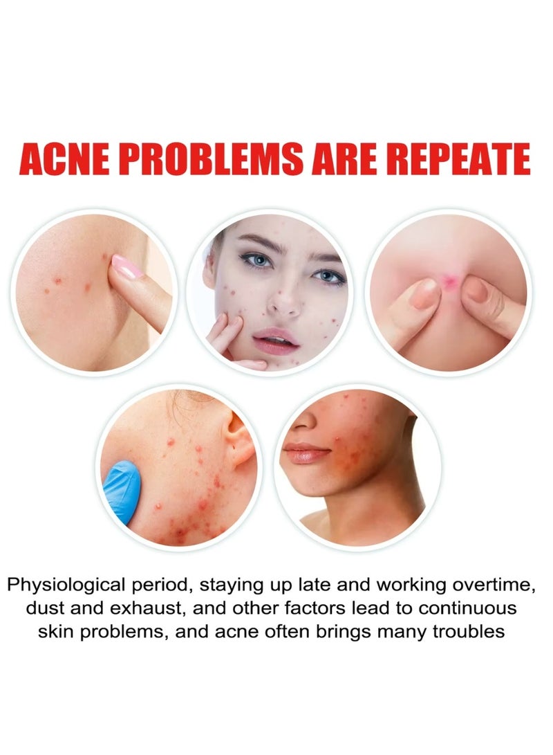 Jaysuing 200 قطعة لاصقات حب الشباب هيدروكولود غير جافة لوجه ملصقات حب الشباب على شكل قلب ملونة مع حمض الهيالورونيك وزيت شجرة الشاي وزيت السنتيلا لاصقات حب الشباب لتغطية العيوب والبثور - Image 2