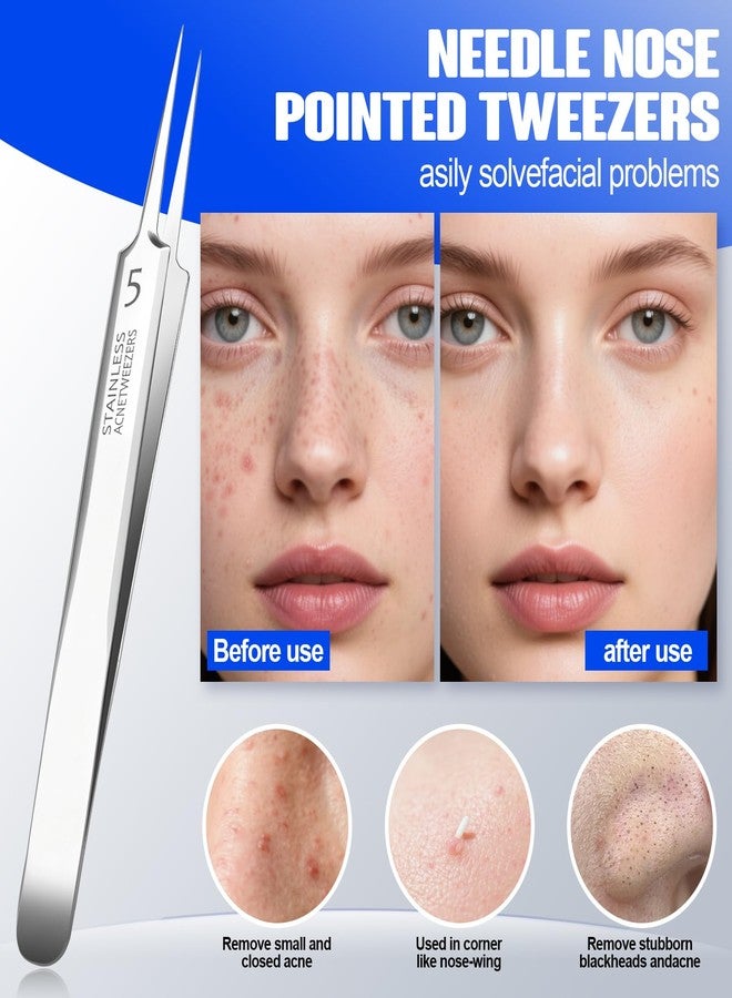 BLAAROOM Professional Blackhead Remover Pimple Popper Tools Kit, Pore Prep Scraper, Precision Nose Blackhead Extractor Tweezers, Black Head Removal for Face Acne, Whitehead Popping Extractor, Blemish Comedone - Image 4