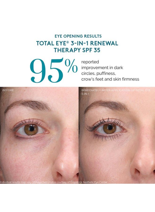 Colorescience Total Eye 3-In-1 Renewal Therapy SPF 35 - Fair 7ml/0.23oz - Image 5