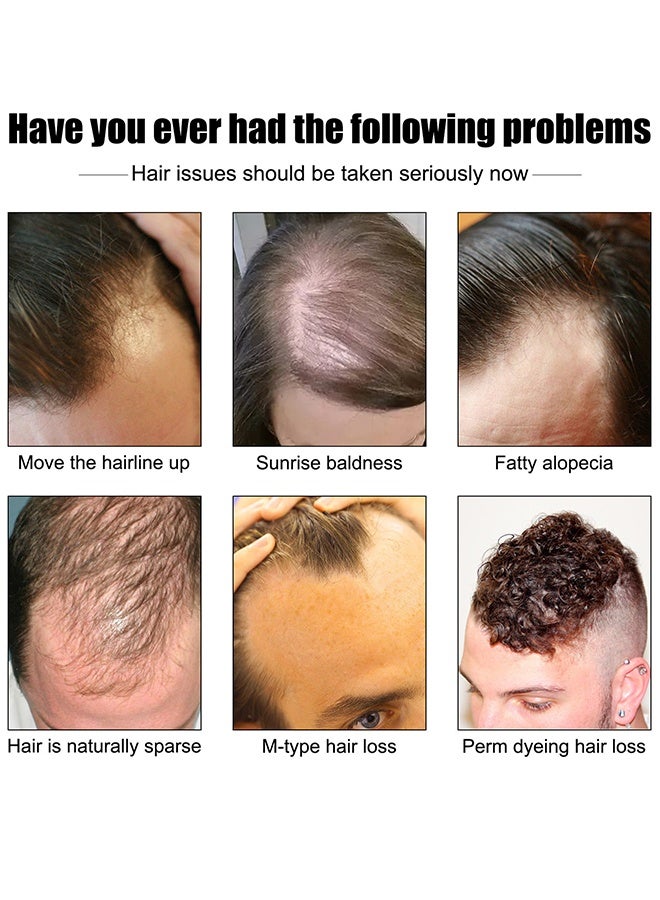 إيست مون زيت خلاصة الشعر ، زيت عطري ، عناية بالشعر لتعزيز نمو الشعر الصحي وتقليل التجعد للشعر الجاف الخفيف والتالف للرجال 30 مل - Image 5